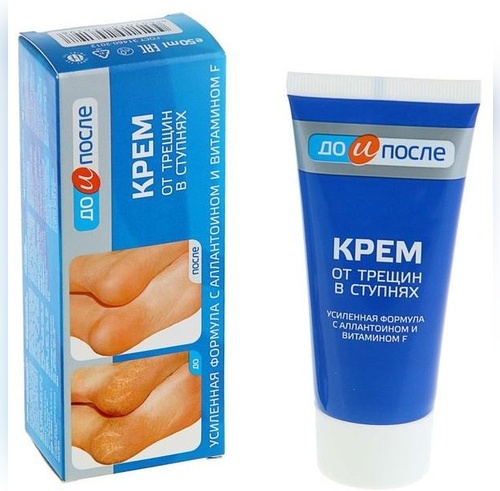 Твинс Тэк ЗАО До и После от трещин в ступнях крем для ног 150 мл